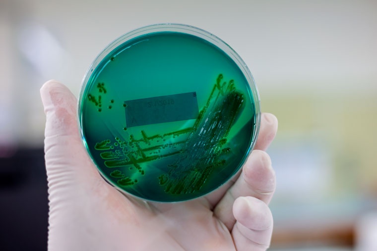 Investigadores identifican nuevas bacterias con potencial para ser usadas como probióticos en acuicultura